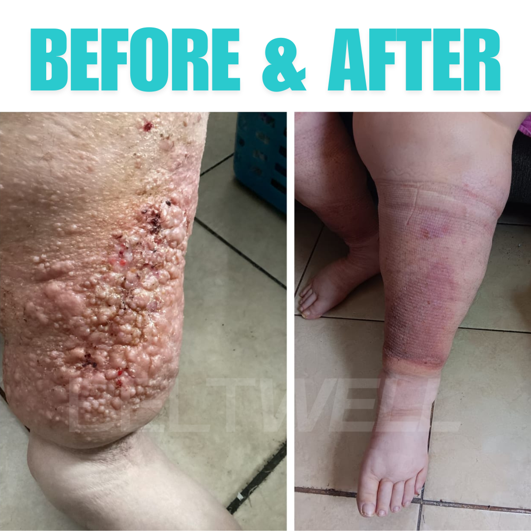 Beltwell® The Full Leg Compression Bundle (Foot, Calf, Thigh) + 8 FREE Bonuses | BLACK